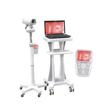 Tıbbi Endoskop Taşınabilir kolpos başa çıkma Jinekoloji için Dijital Video kolpos başa çıkma