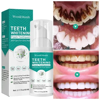Diş Beyazlatma Özü Kaldırmak Plak Lekeleri Serum Taze Nefes Ağız Hijyeni Karşı Diş Çürüğü Diş Diş Temizleme Araçları