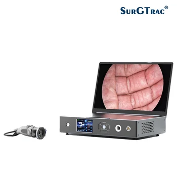 Tıbbi 1080P 60FPS Full HD endoskopi kamerası laparoskopik 100W LED soğuk ışık kaynağı İle 15.6 İnç Ekran monitör